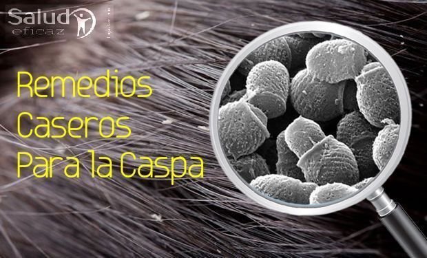 El aceite de almendras en las raíces de los cabello las revocaciones