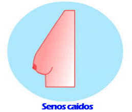 Cuando pasará el hinchazón después del aumento del pecho