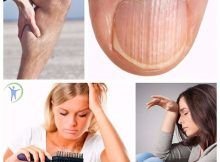 9 señales que acusan deficiencia de proteínas