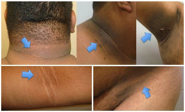 Los niños con las pecas la estampa