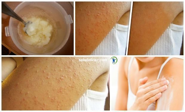 Aerbico cГіmo perder grasa delas piernas los brazos cГіmo perder grasa delas piernas