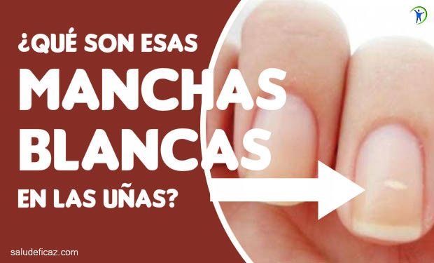 porque salen hongos en las u as porque salen manchas blancas en las u 241 as delas manos porque salen hongos en las u as porque salen manchas blancas en las u 241 as delas manos