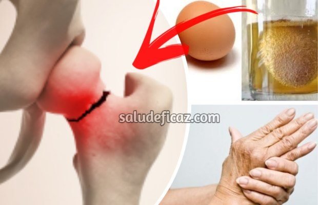 Remedio casero para reponer calcio y fortalecer los huesos