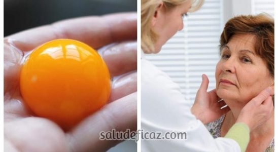 Comer 1 yema de huevo al dia puede curar problemas de tiroides
